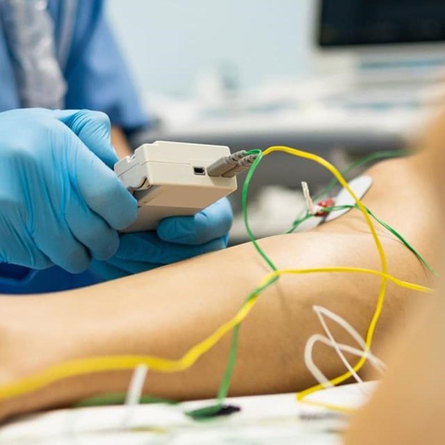 Electrolisis percutánea para lesiones persistentes