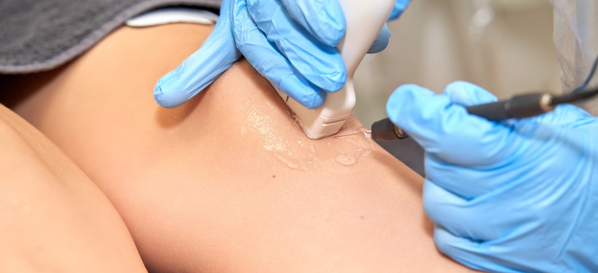 Electrólisis percutánea en Verín