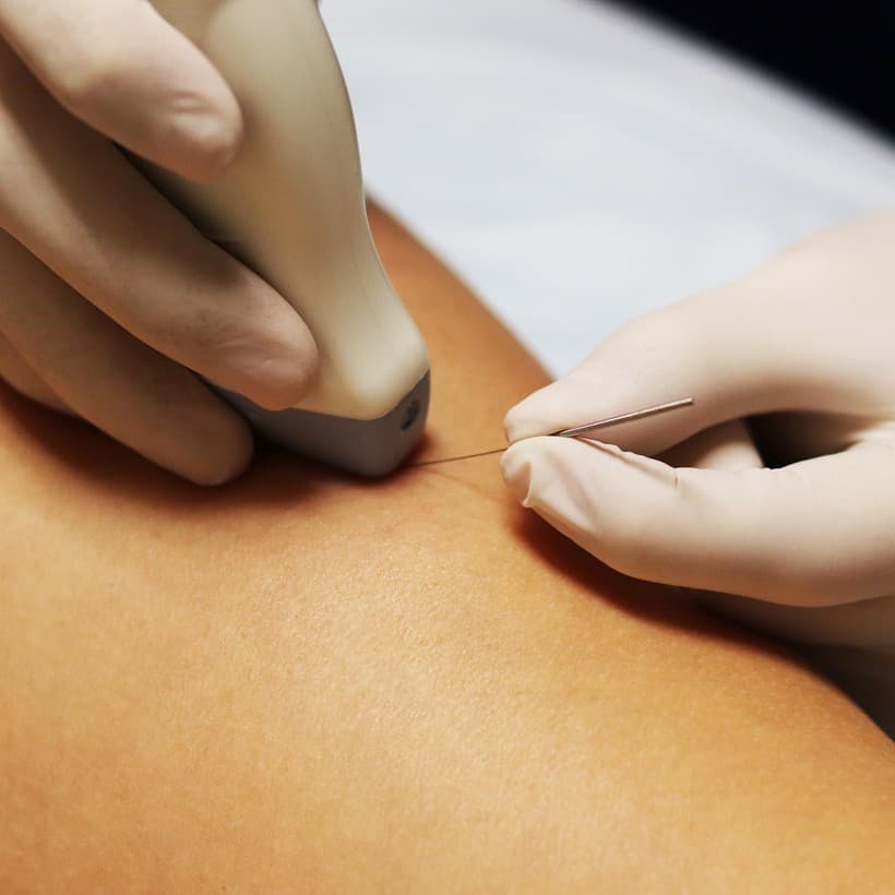 Electrólisis percutánea en Verín