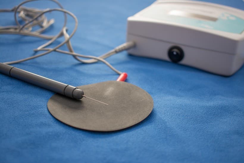 Neuromodulación percutánea en Verín