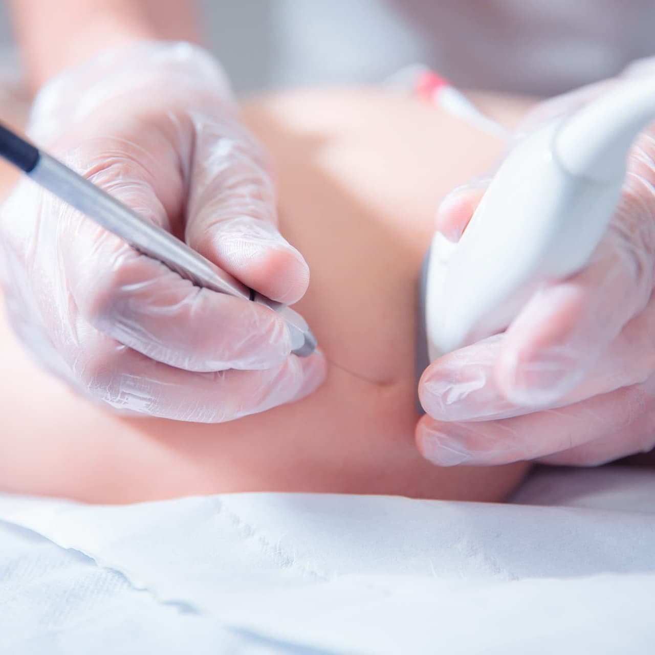 Electrólisis percutánea en Verín